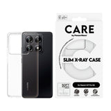 CARE by PanzerGlass - Xiaomi 14T Pro - FASHION X-Ray Soft Basic Cover - Gennemsigtig